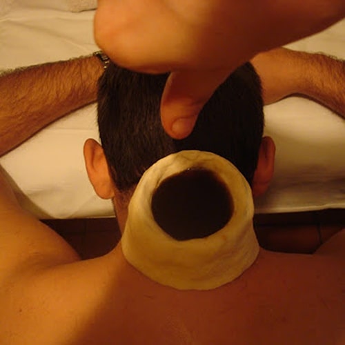Ayurveda
